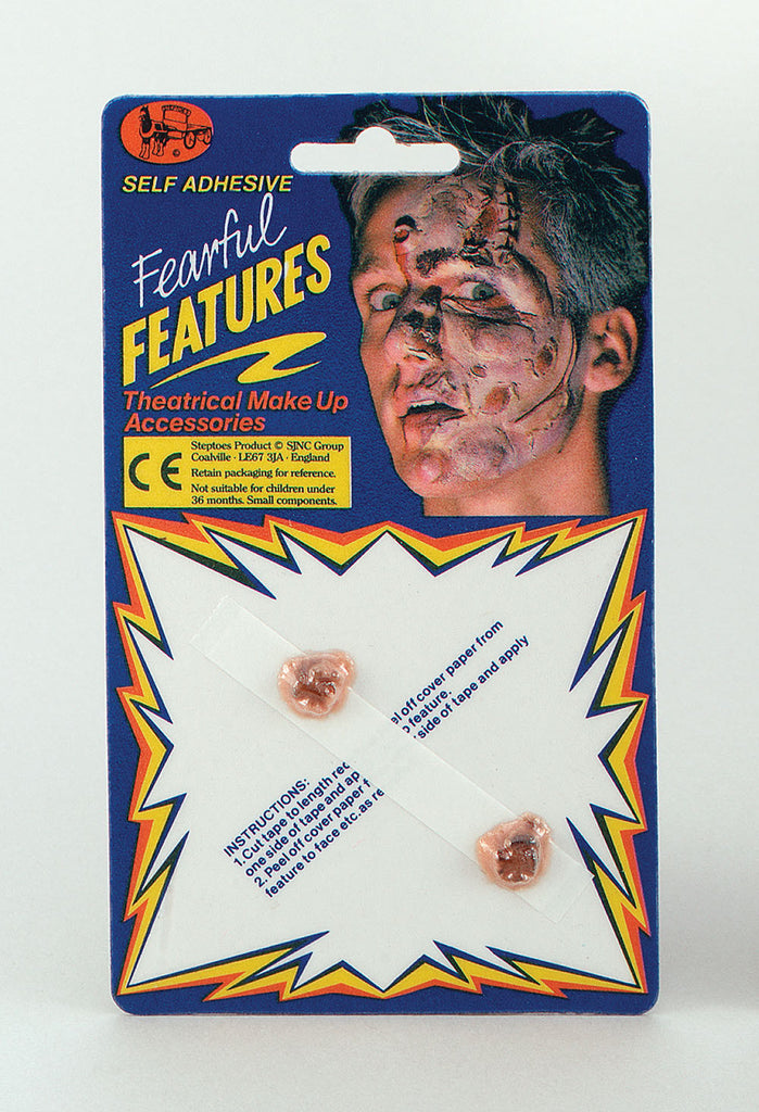 Warts